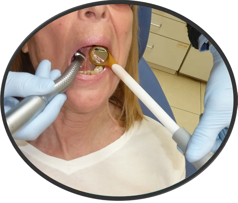 Tanigo Disposable Dental Suction-Mirror